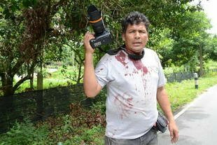 Khao Sod photojournalist Madaree Tohlala suffered significant shrapnel wounds after a bomb exploded near him in Narathiwat on October 19th. Despite his injury, Madaree continued to take pictures to document the attacks by insurgents in the Deep South [Khabar]